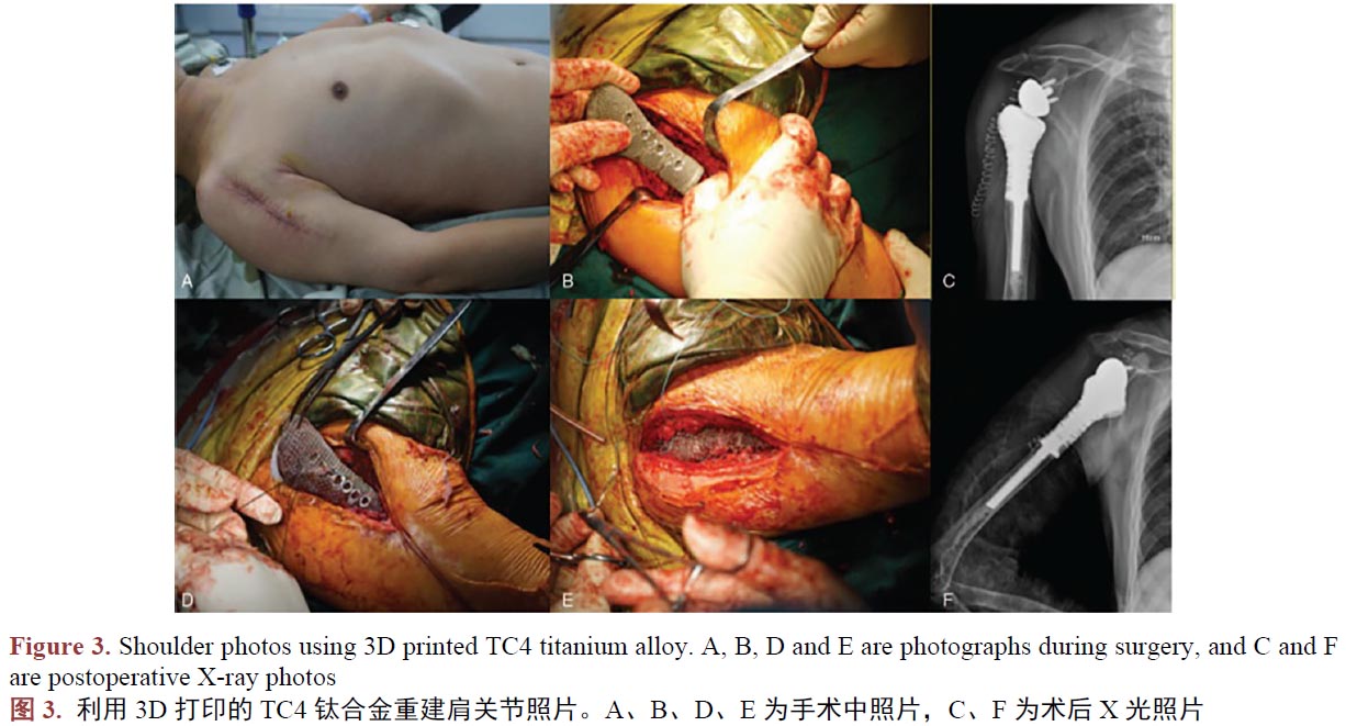 1671021345408895.jpg t3.jpg